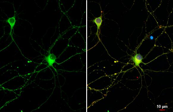 Immunocytochemistry/ Immunofluorescence: Rabbit Tau mAb (HL2736) [NBP3-45160] - Tau antibody [HL2736] detects Tau protein at cytoskeleton by immunofluorescent analysis.Sample: DIV9 rat E18 primary cortical neuron cells were fixed in 4% paraformaldehyde at RT for 15 min. Green: Tau stained by Tau antibody [HL2736] diluted at 1:250. Red: Tau, an axon marker, stained by Tau antibody [GT287] diluted at 1:500. Blue: Fluoroshield with DAPI.