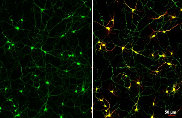 Immunocytochemistry/ Immunofluorescence: Rabbit Tau mAb (HL2736) [NBP3-45160] - Tau antibody [HL2736] detects Tau protein at cytoskeleton by immunofluorescent analysis. Sample: DIV9 rat E18 primary cortical neuron cells were fixed in 4% paraformaldehyde at RT for 15 min.Green: Tau stained by Tau antibody [HL2736] diluted at 1:250.Red: Tau, an axon marker, stained by Tau antibody [GT287] diluted at 1:500.Blue: Fluoroshield with DAPI.