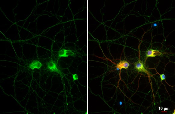 <b>Genetic Strategies Validation. </b>Immunohistochemistry: Rabbit Tau mAb (HL2736) [NBP3-45160] - Tau antibody [HL2736] detects Tau protein by immunofluorescent analysis.Sample: DIV11 rat E18 primary cortical neuron cells were fixed in 4% paraformaldehyde at RT for 15 min.Green: Tau stained by Tau antibody [HL2736]  diluted at 1:250.Red: MAP2, a microtubule marker, stained by MAP2 antibody [HM-2] diluted at 1:500.