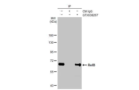 Immunoprecipitation of RelB protein from Raji whole cell extract using 5 ug of RelB antibody [HL2222] (NBP3-25623).Western blot analysis was performed using RelB antibody [HL2222] (NBP3-25623).EasyBlot HRP-conjugated anti rabbit IgG antibody . 