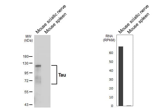 <b>Orthogonal Strategies Validation. </b>Various tissue extracts (50 ug) were separated by 7.5% SDS-PAGE, and the membrane was blotted with Tau antibody [HL2736] (NBP3-45160) diluted at 1:1000. The HRP-conjugated anti-rabbit IgG antibody was used to detect the primary antibody. Corresponding RNA expression data are based on NCBI database. 