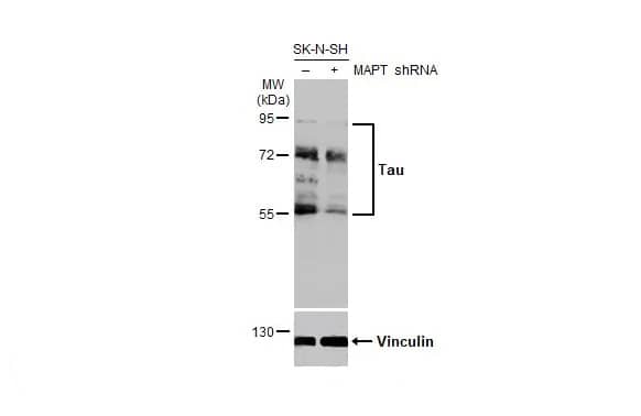 Western Blot: Rabbit Tau mAb (HL2736) [NBP3-45160] - Non-transfected (–) and transfected (+) SK-N-SH whole cell extracts (30 ug) were separated by 7.5% SDS-PAGE, and the membrane was blotted with Tau antibody [HL2736] diluted at 1:500. The HRP-conjugated anti-rabbit IgG antibody was used to detect the primary antibody, and the signal was developed with Trident ECL plus-Enhanced.