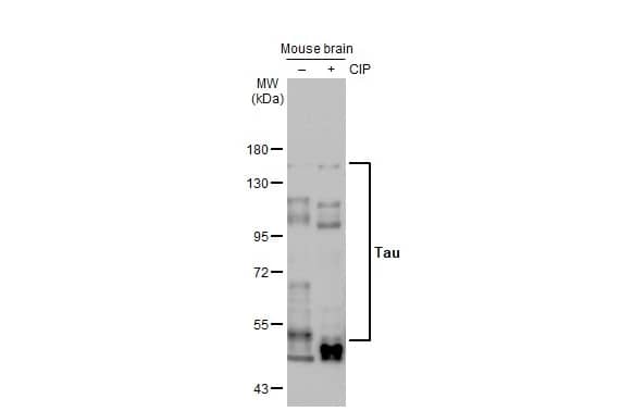 <b>Biological Strategies Validation. </b>Western Blot: Rabbit Tau mAb (HL2736) [NBP3-45160] - Untreated (–) and treated (+) mouse tissue extract (50 μg) were separated by 7.5% SDS-PAGE, and the membrane was blotted with Tau antibody [HL2736] diluted at 1:1000. The HRP-conjugated anti-rabbit IgG antibody was used to detect the primary antibody.