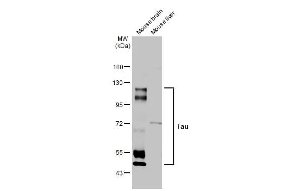 Western Blot: Rabbit Tau mAb (HL2736) [NBP3-45160] - Various tissue extracts (50 ug) were separated by 7.5% SDS-PAGE, and the membrane was blotted with Tau antibody [HL2736] diluted at 1:1000. The HRP-conjugated anti-rabbit IgG antibody was used to detect the primary antibody.