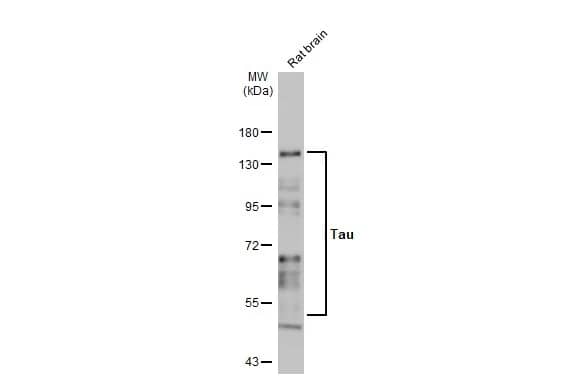 Western Blot: Rabbit Tau mAb (HL2736) [NBP3-45160] - Rat tissue extract (50 ug) was separated by 7.5% SDS-PAGE, and the membrane was blotted with Tau antibody [HL2736] diluted at 1:1000. The HRP-conjugated anti-rabbit IgG antibody was used to detect the primary antibody.