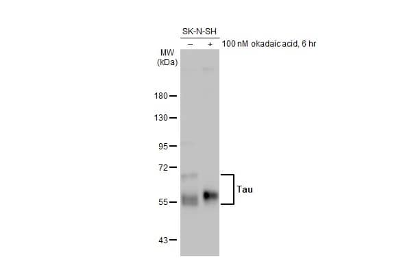 <b>Biological Strategies Validation. </b>Western Blot: Rabbit Tau mAb (HL2736) [NBP3-45160] - Untreated (–) and treated (+) SK-N-SH whole cell extract (30 μg) were separated by 7.5% SDS-PAGE, and the membrane was blotted with Tau antibody [HL2736] diluted at 1:500. The HRP-conjugated anti-rabbit IgG antibody was used to detect the primary antibody.