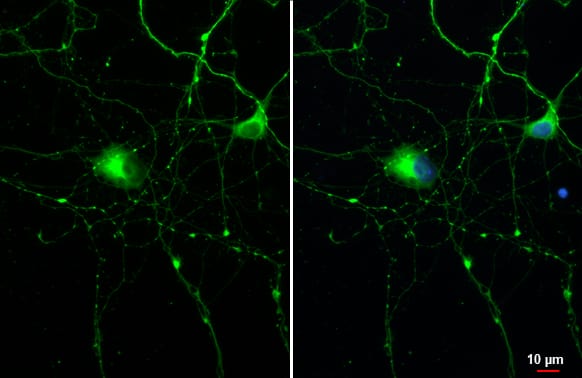Immunocytochemistry/ Immunofluorescence: Rabbit Tau mAb (HL2802) [NBP3-45161] - Tau antibody [HL2802] detects Tau protein at cytoskeleton by immunofluorescent analysis.Sample: DIV9 rat E18 primary cortical neuron cells were fixed in 4% paraformaldehyde at RT for 15 min.Green: Tau stained by Tau antibody [HL2802] diluted at 1:250.Blue: Fluoroshield with DAPI.