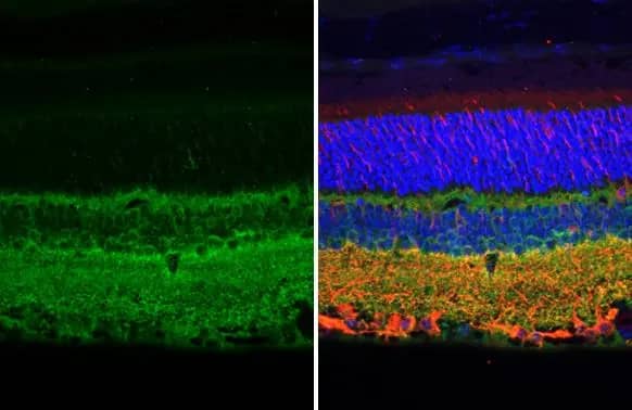 Immunohistochemistry: Rabbit Tau mAb (HL2802) [NBP3-45161] - Tau antibody [HL2802] detects Tau protein at cytoplasm by immunohistochemical analysis. Sample: Paraffin-embedded mouse eye. Green: Tau stained by Tau antibody [HL2802] diluted at 1:100. Red: beta Tubulin 3/ Tuj1, a neural marker, stained by beta Tubulin 3/ Tuj1 diluted at 1:500. Blue: Fluoroshield with DAPI. Antigen Retrieval: Citrate buffer, pH 6.0, 15 min