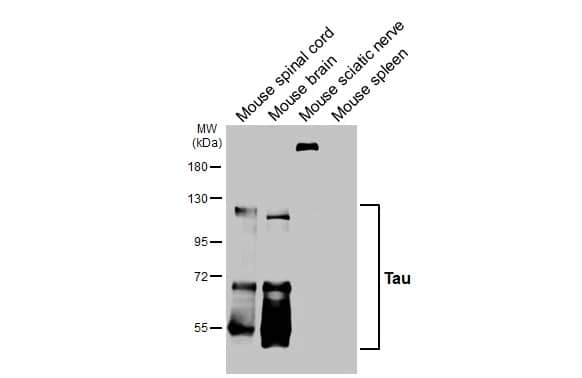 Western Blot: Rabbit Tau mAb (HL2802) [NBP3-45161] - Various tissue extracts (50 μg) were separated by 7.5% SDS-PAGE, and the membrane was blotted with Tau antibody [HL2802] diluted at 1:1000. The HRP-conjugated anti-rabbit IgG antibody was used to detect the primary antibody.