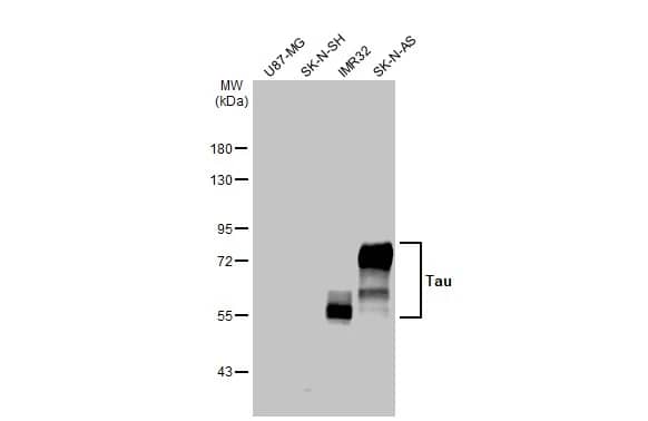 Western Blot: Rabbit Tau mAb (HL2802) [NBP3-45161] - Various whole cell extracts (30 ug) were separated by 7.5% SDS-PAGE, and the membrane was blotted with Tau antibody [HL2802] diluted at 1:1000. The HRP-conjugated anti-rabbit IgG antibody was used to detect the primary antibody.
