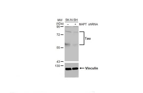 Western Blot: Rabbit Tau mAb (HL2802) [NBP3-45161] - Non-transfected (–) and transfected (+) SK-N-SH whole cell extracts (30 ug) were separated by 7.5% SDS-PAGE, and the membrane was blotted with Tau antibody [HL2802] diluted at 1:1000. The HRP-conjugated anti-rabbit IgG antibody was used to detect the primary antibody.