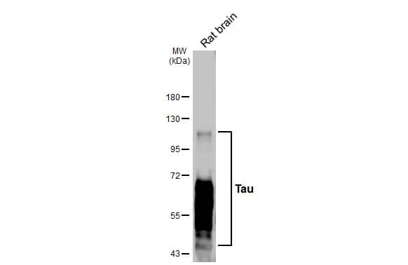 <b>Genetic Strategies Validation. </b>Western Blot: Rabbit Tau mAb (HL2802) [NBP3-45161] - Rat tissue extract (50 ug) was separated by 7.5% SDS-PAGE, and the membrane was blotted with Tau antibody [HL2802] diluted at 1:1000. The HRP-conjugated anti-rabbit IgG antibody was used to detect the primary antibody.