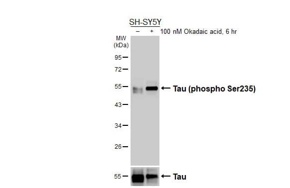 Untreated (–) and treated (+) SH-SY5Y whole cell extracts (30 ug) were separated by 10% SDS-PAGE, and the membranes were blotted with Tau (pSer235) antibody (HL3899) diluted at 1:1000 and Tau antibody [HL2982] diluted at 1:1000. The HRP-conjugated anti-rabbit IgG antibody was used to detect the primary antibody.