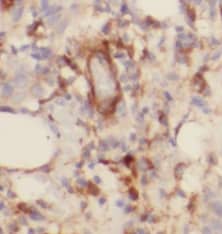 Immunohistochemistry TOMM6 Antibody - BSA Free