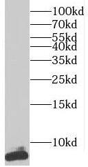 Western Blot: TNP1 Antibody - BSA Free [NBP3-45170] - Mouse testis tissue were subjected to SDS PAGE followed by western blot with (TNP1 antibody) at dilution of 1:1000