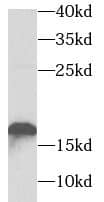 Western Blot TNNC2 Antibody - BSA Free