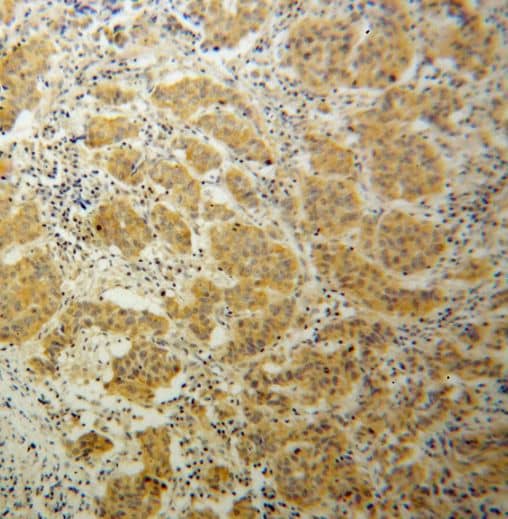 Immunohistochemistry Tnk1 Antibody - BSA Free
