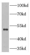 Western Blot TNIP2 Antibody - BSA Free