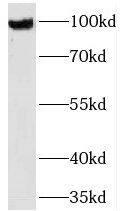 Western Blot: TMTC1 Antibody - BSA Free [NBP3-45178] - Mouse bladder tissue were subjected to SDS PAGE followed by western blot with (TMTC1 antibody) at dilution of 1:1000