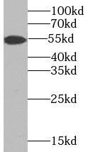 Western Blot TMPRSS4 Antibody - BSA Free