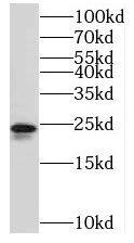 Western Blot: TMEM9 Antibody - BSA Free [NBP3-45186] - LNCaP cells were subjected to SDS PAGE followed by western blot with (TMEM9 antibody) at dilution of 1:100
