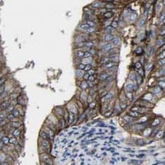 Immunohistochemistry DRAM2 Antibody - BSA Free