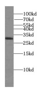Western Blot DRAM2 Antibody - BSA Free