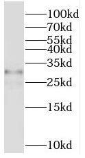 Western Blot: TMEM55B Antibody - BSA Free [NBP3-45189] - MCF-7 cells were subjected to SDS PAGE followed by western blot with (TMEM55B antibody) at dilution of 1:500