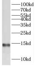 Western Blot: TMEM50B Antibody - BSA Free [NBP3-45190] - Mouse testis tissue were subjected to SDS PAGE followed by western blot with (TMEM50B antibody) at dilution of 1:200
