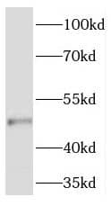 Western Blot TMEM5 Antibody - BSA Free