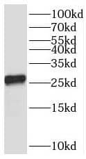 Western Blot: TMEM41A Antibody - BSA Free [NBP3-45192] - Mouse small intestine tissue were subjected to SDS PAGE followed by western blot with (TMEM41A antibody) at dilution of 1:800