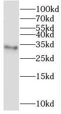 Western Blot: TMEM38A Antibody - BSA Free [NBP3-45194] - Mouse skeletal muscle tissue were subjected to SDS PAGE followed by western blot with (TMEM38A antibody) at dilution of 1:400