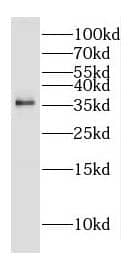 Western Blot DOK5 Antibody - BSA Free