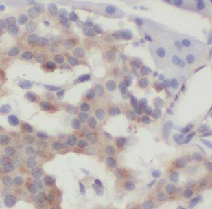 Immunohistochemistry: DNAJC21 Antibody - BSA Free [NBP3-45200] - Immunohistochemistry of paraffin-embedded human pancreas tissue slide using (DNAJC21 Antibody) at dilution of 1:50