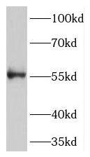 Western Blot: MGC4618 Antibody - BSA Free [NBP3-45211] - HepG2 cells were subjected to SDS PAGE followed by western blot with (MGC4618 antibody) at dilution of 1:500