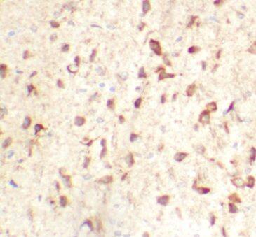 Immunohistochemistry: MGC4618 Antibody - BSA Free [NBP3-45211] - Immunohistochemistry of paraffin-embedded mouse brain using (MGC4618 antibody) at dilution of 1:100