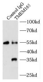 Immunoprecipitation TMEM165 Antibody - BSA Free
