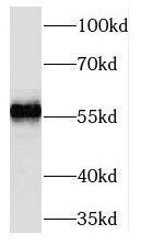 Western Blot TMEM161A Antibody - BSA Free
