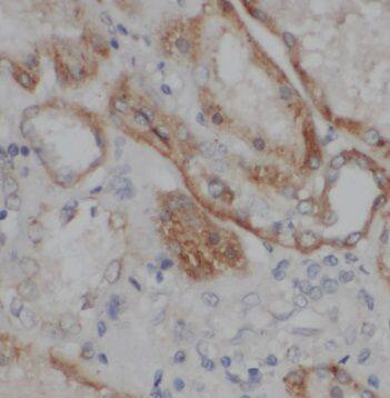 Immunohistochemistry TMEM154 Antibody - BSA Free