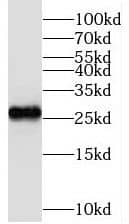 Western Blot TMEM139 Antibody - BSA Free