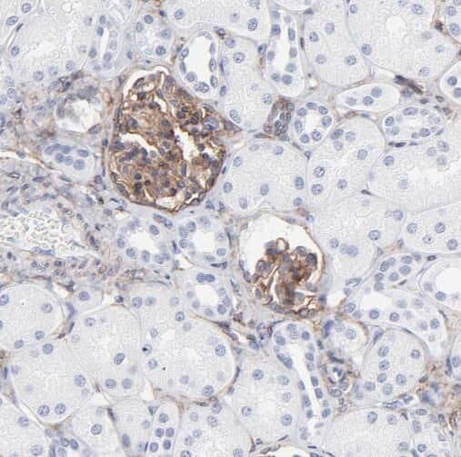 Immunohistochemistry TMEM120B Antibody - BSA Free