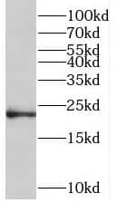 Western Blot: TMEM11 Antibody - BSA Free [NBP3-45222] - Human placenta tissue were subjected to SDS PAGE followed by western blot with (TMEM11 antibody) at dilution of 1:1000