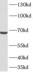 Western Blot: TMEM108 Antibody - BSA Free [NBP3-45223] - Jurkat cells were subjected to SDS PAGE followed by western blot with ( TMEM108 Antibody) at dilution of 1:1000