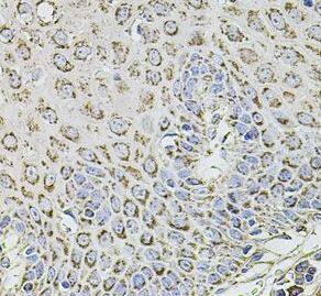 Immunohistochemistry TMC1 Antibody - BSA Free