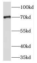 Western Blot: TM9SF4 Antibody - BSA Free [NBP3-45231] - A431 cells were subjected to SDS PAGE followed by western blot with (TM9SF4 Antibody) at dilution of 1:1000