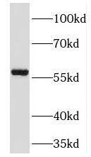 Western Blot TM7SF2 Antibody - BSA Free