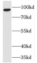 Western Blot: TJAP1 Antibody - BSA Free [NBP3-45234] - Human skeletal muscle tissue were subjected to SDS PAGE followed by western blot with (TJAP1 antibody) at dilution of 1:1500