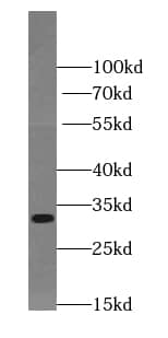Western Blot: TIMMDC1 Antibody - BSA Free [NBP3-45235] - A375 cells were subjected to SDS PAGE followed by western blot with (TIMMDC1 antibody) at dilution of 1:1000