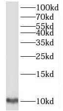 Western Blot: TIMM9 Antibody - BSA Free [NBP3-45236] - A549 cells were subjected to SDS PAGE followed by western blot with (TIMM9 antibody) at dilution of 1:300