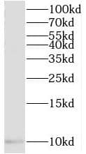 Western Blot: TIMM10 Antibody - BSA Free [NBP3-45239] - Human heart tissue were subjected to SDS PAGE followed by western blot with (TIMM10 antibody) at dilution of 1:500